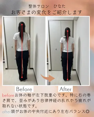 整体サロン　ひなた~HINATA~ 　京阪七条　京都店所属・肩こり反り腰改善専門 筋膜✨整体ひなたのエステ・リラクイメージ