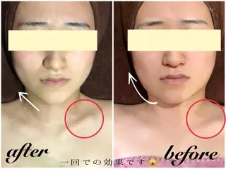 うなじ/もみあげ脱毛 ヴィシェーン佐藤のその他イメージ