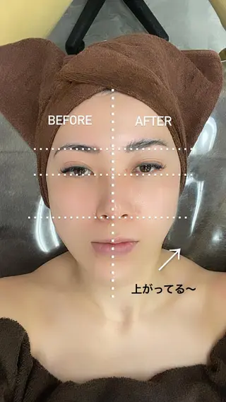 メンズ マツエク・マツパ アイブロウ Amm所属・🏆艶肌ワックス🏆 ララピール✨Ammのエステ・リラクイメージ