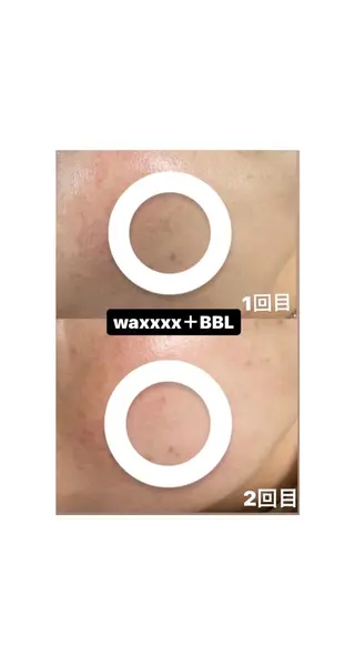 Epina 千葉店 【エピナ】のエステ・リラクイメージ