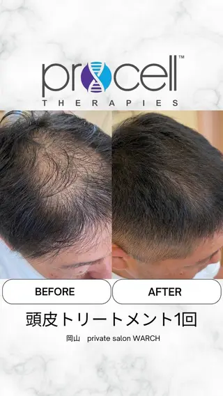 WARCH Marieのその他イメージ