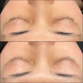 LiZA エステティックサロンのエステ・リラクイメージ