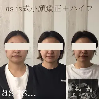 小顔専門アズイズ ビューティー　草津店のエステ・リラクイメージ