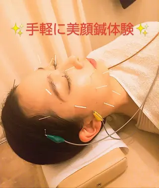 むくみたるみ専門☆ 美容鍼・小顔矯正のエステ・リラクイメージ