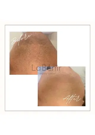 メンズ 脱毛/美肌【皮膚科看 護師経営】ラベニールのエステ・リラクイメージ