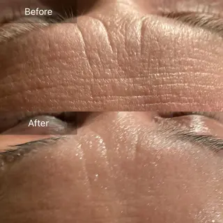 Mandarin Orange所属・毛穴から始める肌メン テマンダリンオレンジのエステ・リラクイメージ