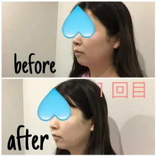 アルカンジュ~archange~所属・痩身/毛穴洗浄/脱毛 アルカンジュのエステ・リラクイメージ