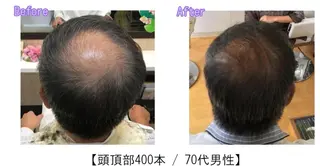 ヘアアレンジ 高津private salonのマツエク・マツパデザイン