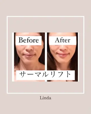 アイラッシュ&エステサロンLinda西宮所属・小顔&肌質改善 LINDA西宮 AIのエステ・リラクイメージ