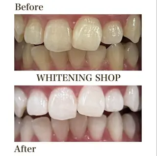 ホワイトニング ショップ葛西店のその他イメージ