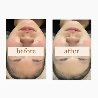 crescent所属・【韓国肌管理・脱毛】 クレセントのエステ・リラクイメージ