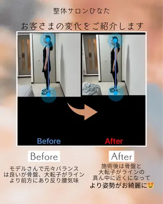 整体サロン　ひなた~HINATA~ 　京阪七条　京都店所属・肩こり反り腰改善専門 筋膜✨整体ひなたのエステ・リラクイメージ