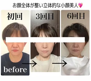 小顔と ヘッドスパのお店のエステ・リラクイメージ