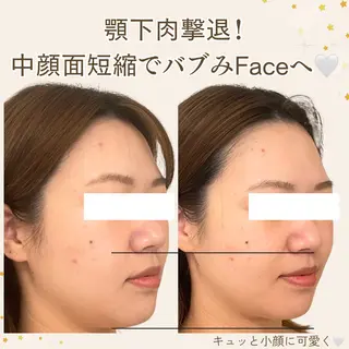 小顔/たるみ/黒ずみ除去専門サロン/SONA 大和西大寺店所属・【小顔専門看護師 サロンSONA】のエステ・リラクイメージ