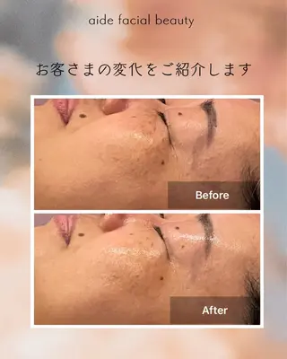 aide facial beauty所属・aide 肌質改善サロンのエステ・リラクイメージ