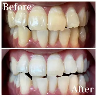 LBSホワイトニング 🌐梅田店公式のエステ・リラクイメージ