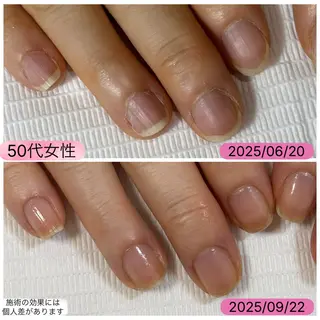 ネイル 自爪育成専門サロン エムロードゥ池下のネイルデザイン