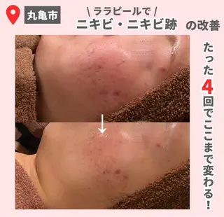 前山 くるみのエステ・リラクイメージ