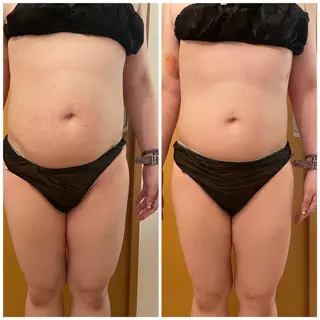 ✨美肌水光✨ アトリエリュバンのエステ・リラクイメージ