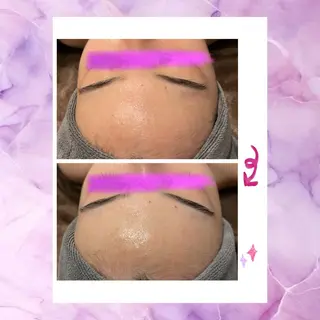 ☆痩身/小顔☆ 結果出します☆のエステ・リラクイメージ