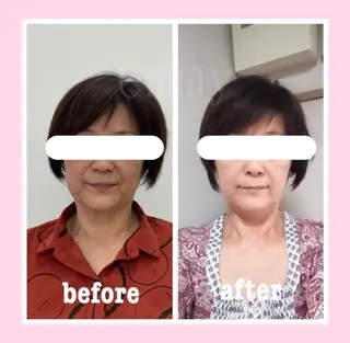 小顔と ヘッドスパのお店のエステ・リラクイメージ