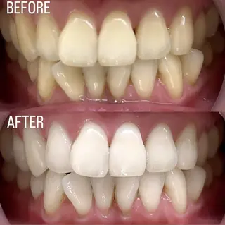 LBSホワイトニング 銀座店💎店長浦和のその他イメージ