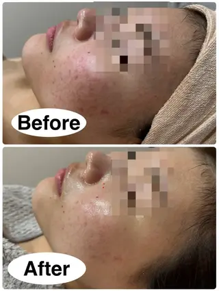 美肌脱毛専門サロン muro.のエステ・リラクイメージ