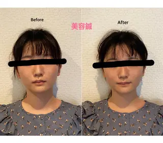 チキバン美容鍼灸整体 サロン心斎橋店のエステ・リラクイメージ