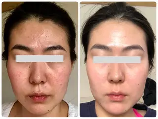 肌質改善サロン La Divinaのエステ・リラクイメージ