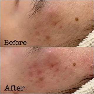 ルリアンチッタ メンズ垢抜け特化の眉毛・アイブロウイメージ