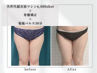 小顔矯正専門店 【RED】池田のエステ・リラクイメージ