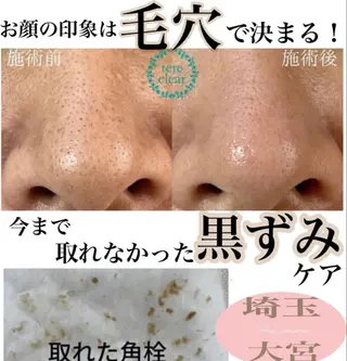 private salon Dea_maris シュガーリング&パーソナルボディケア所属・シミ改善・韓国肌管理 ボディメイク痩身のその他イメージ