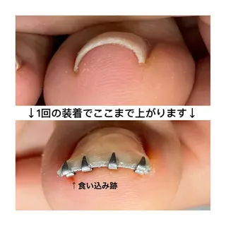 ネイル Lety total beautyのエステ・リラクイメージ