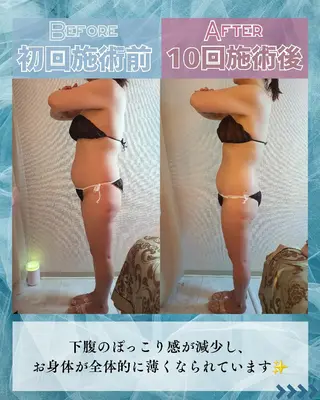 痩身ハーブピーリング 筋膜リリース☆B&Hのエステ・リラクイメージ