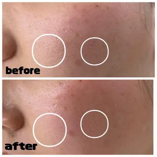 デ・アイム新潟北所属・サイトウ .のエステ・リラクイメージ