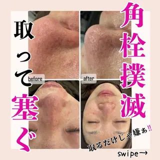 毛穴洗浄専門サロン/CareNa梅田【毛穴/ケアナ】所属・CareNa梅田店 🌿住田摩利弥のエステ・リラクイメージ