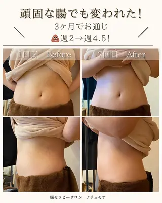 腸セラピーサロン ナチュモアのエステ・リラクイメージ