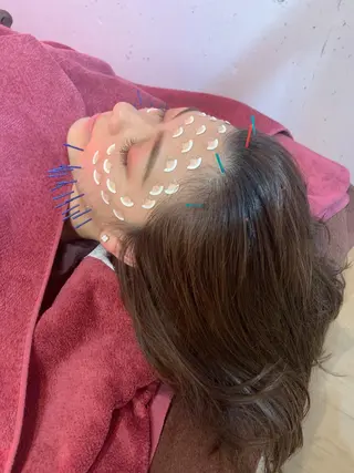 美容鍼灸女性専用 りんご鍼灸治療院のその他イメージ