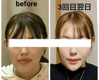 小顔と美肌 まごころエステMatoria所属・小顔 美肌専門 Matoriaのエステ・リラクイメージ