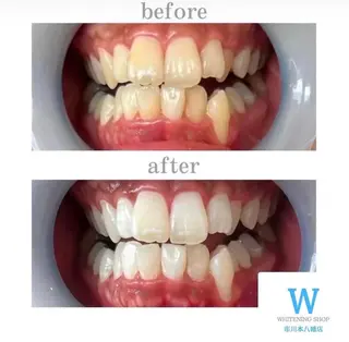 メンズ ホワイトニング ショップ本八幡店のエステ・リラクイメージ