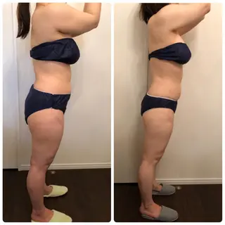 FLEUR大阪・美容 整体・痩身・小顔のエステ・リラクイメージ