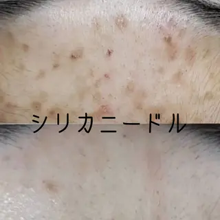 目元・まつパ・美肌フ ェイシャル谷町四丁目のマツエク・マツパデザイン