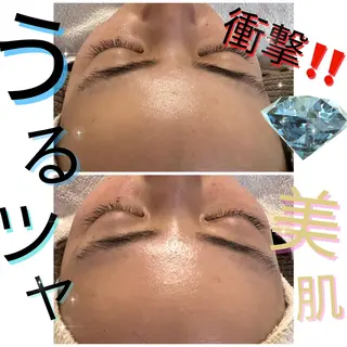 【小顔コルギ＆脱毛専門店⠀】PulBeaute～プリュボーテ～所属・PulBeaute 立川店のエステ・リラクイメージ