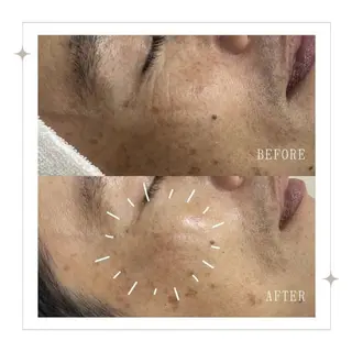 🌺 SAKI 🌺のマツエク・マツパデザイン