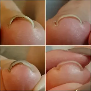 ネイル Jeliss~美爪育成ネイル＆頭蓋骨小顔矯正サロン~所属・美顔(小顔)矯正& 美爪育成Jelissのエステ・リラクイメージ