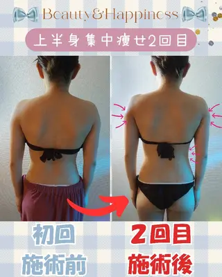 痩身ハーブピーリング 筋膜リリース☆B&Hのエステ・リラクイメージ