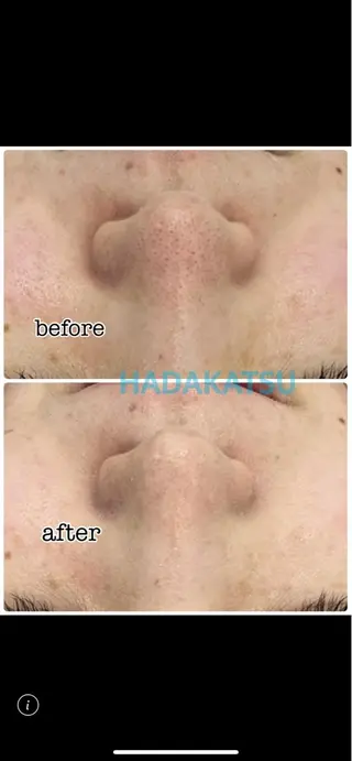 総合エステサロン 肌活のエステ・リラクイメージ