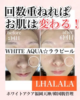 メンズ キッズ WHITEAQUA 福岡天神店のエステ・リラクイメージ