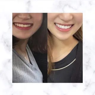 ホワイトニング専門店 LCS 銀座店 峰岡のその他イメージ