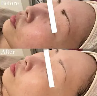 ✨美肌水光✨ アトリエリュバンのエステ・リラクイメージ